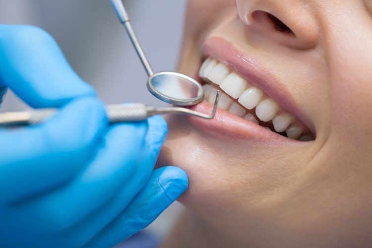 Photo of Dentist Examining a Patient's Teeth