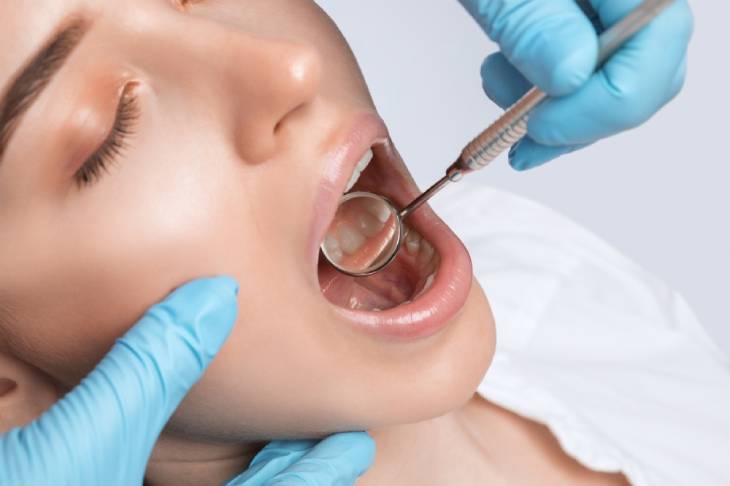 Common Dentures Misconceptions Photo of a dental work