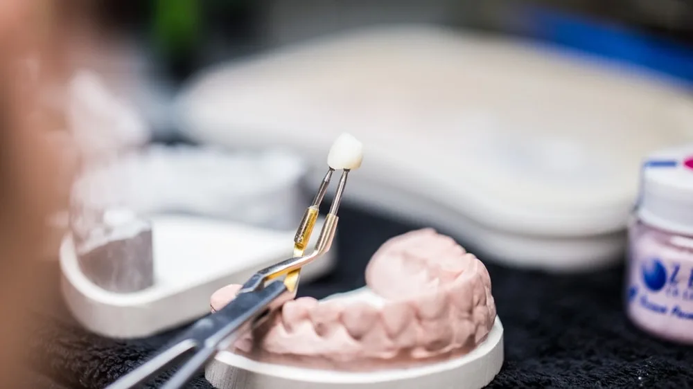 A dental technician carefully holds a crafted dental crown using tweezers over a model of teeth in a professional laboratory environment, illustrating precision in restorative dentistry.