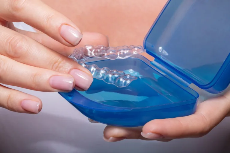 Woman's Hand Putting Transparent Aligner In Blue Case